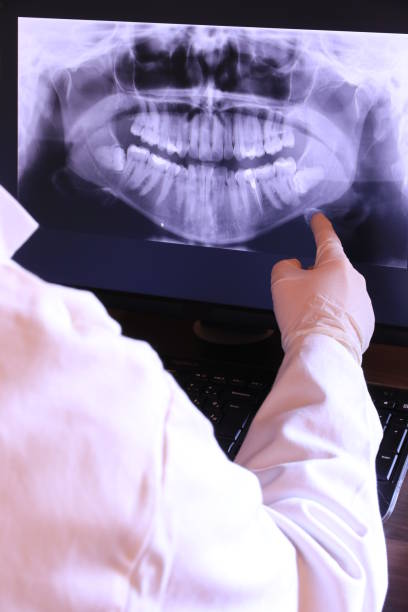 Best Knocked-Out Tooth (Avulsed Tooth) Treatment in Edgewood, PA